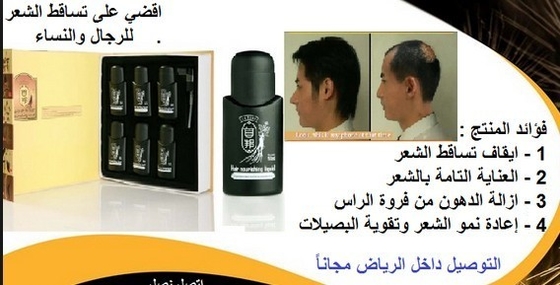 Rambut rontok obat rambut transplantasi rambut rontok perawatan rambut rontok pada wanita 6 * 50ml